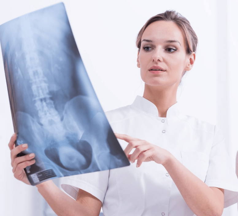 Рентгенологиялық зерттеу арқылы кеуде остеохондрозының диагностикасы